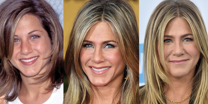 Jennifer Aniston Plastic Surgery Before and After Pictures 2020.