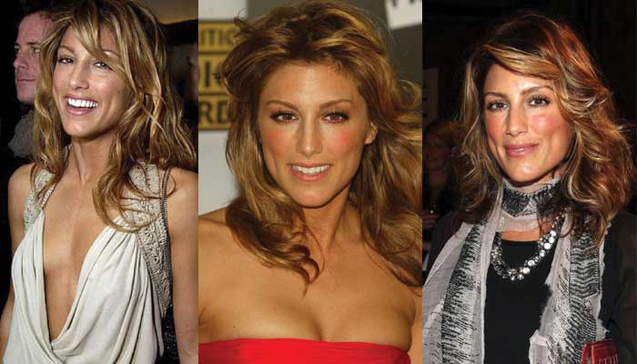Jennifer Esposito Plastic Surgery Before and After 2022
