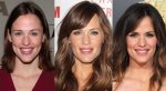 Jennifer Garner Plastic Surgery