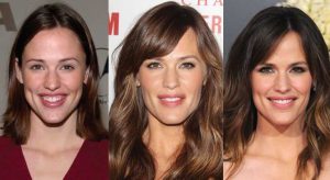 jennifer garner plastic surgery