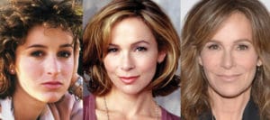 jennifer grey plastic surgery