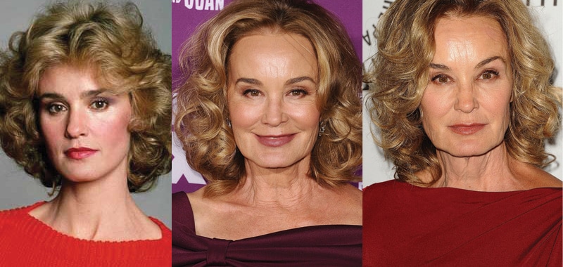 jessica lange plastic surgery