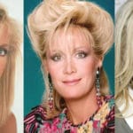 Joan Van Ark Plastic Surgery