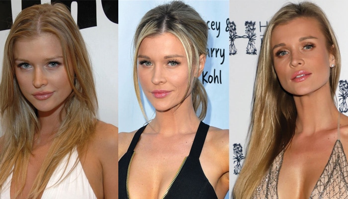 joanna krupa plastic surgery