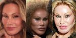 Jocelyn Wildenstein Plastic Surgery