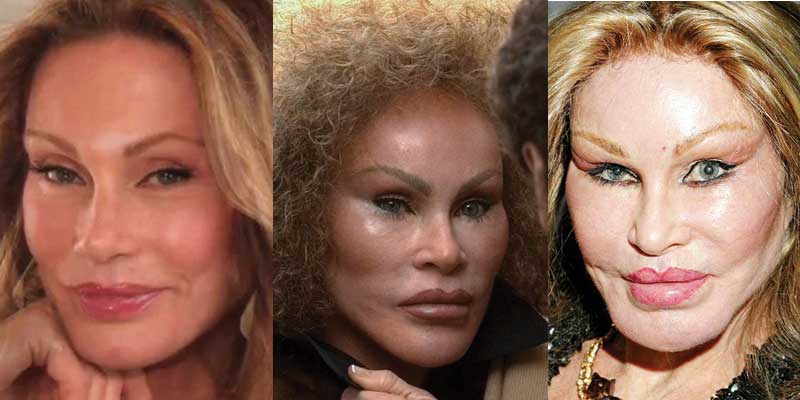 Jocelyn Wildenstein Plastic Surgery Before and After 2023