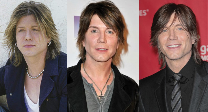 johnny rzeznik plastic surgery