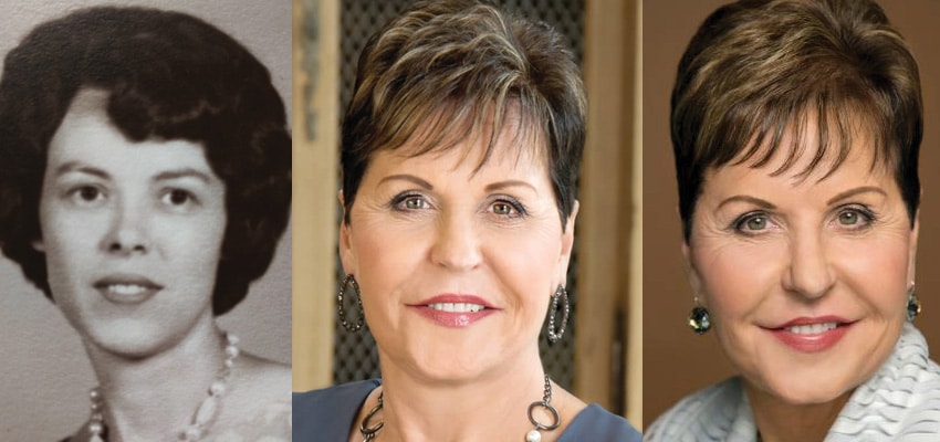 Joyce Meyer Plastic Surgery Before and After Pictures 2020.