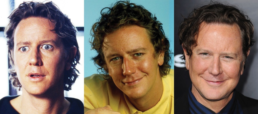 judge reinhold plastic surgery