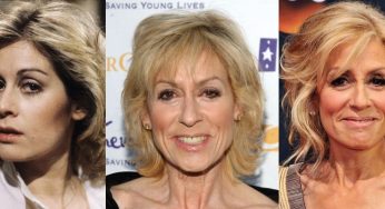 Judith Light Plastic Surgery