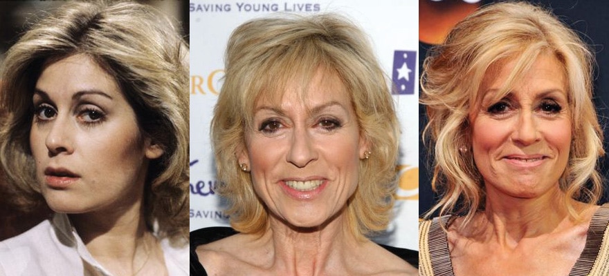 Judith Light Plastic Surgery Before and After 2022