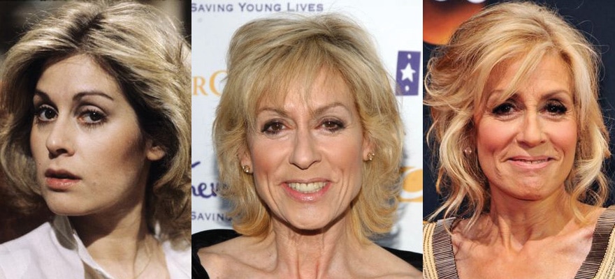 judith light plastic surgery