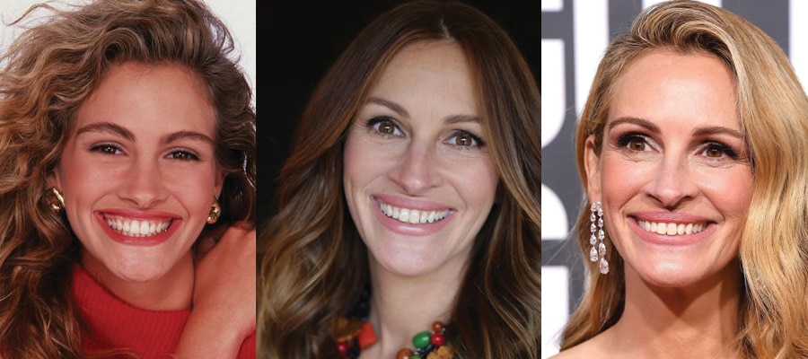 Julia Roberts Plastic Surgery Before and After 2023