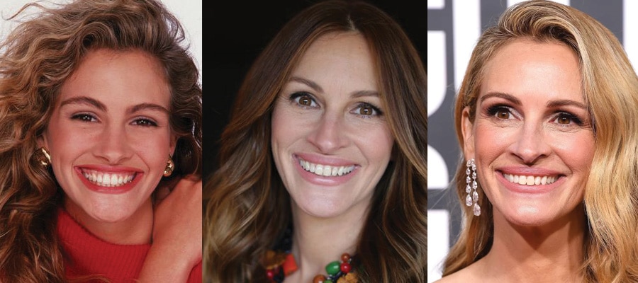 julia roberts plastic surgery