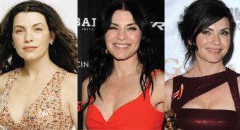 Julianna Margulies Plastic Surgery