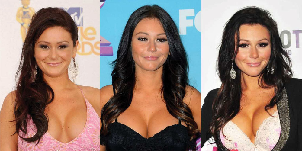 JWoww Plastic Surgery Before and After 2024