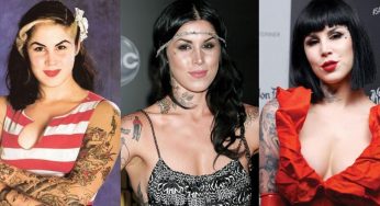 Kat Von D Plastic Surgery