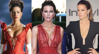 Kate Beckinsale Plastic Surgery