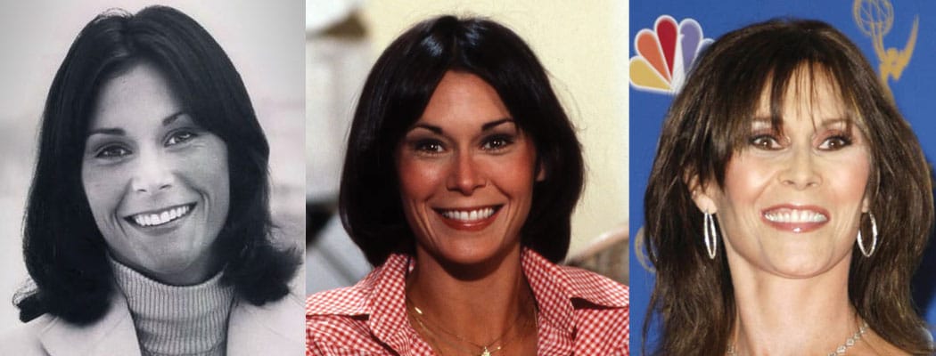 kate jackson plastic surgery before and after