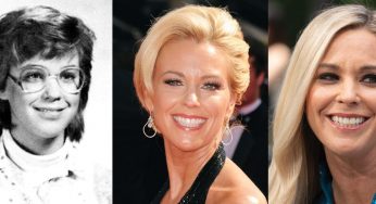 Kate Gosselin Plastic Surgery