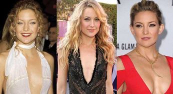 Kate Hudson Plastic Surgery