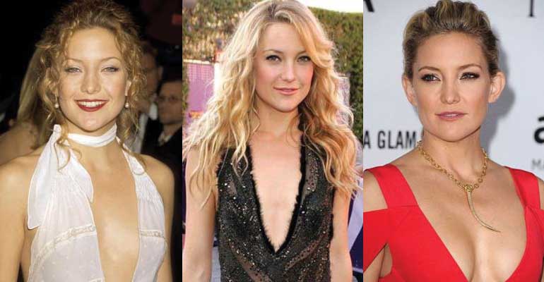 Kate Hudson Plastic Surgery Before and After Pictures 2020.