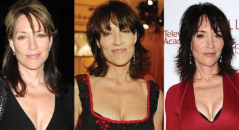 Kate Sagal Plastic Surgery