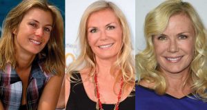 katherine kelly lang plastic surgery