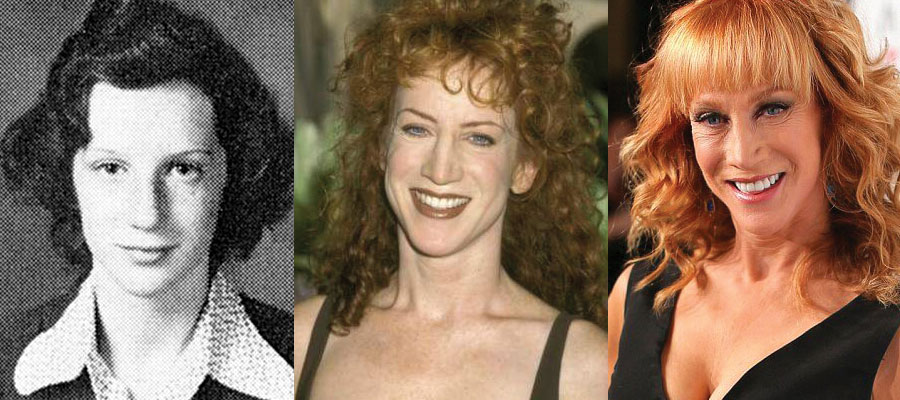 Kathy Griffin Plastic Surgery Before and After Pictures 2021