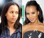 Kerry Washington Plastic Surgery