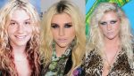 Kesha Plastic Surgery