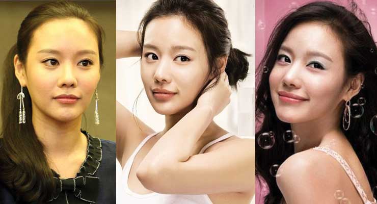 kim ah joong plastic surgery