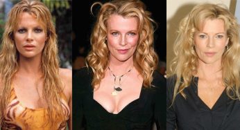 Kim Basinger Plastic Surgery