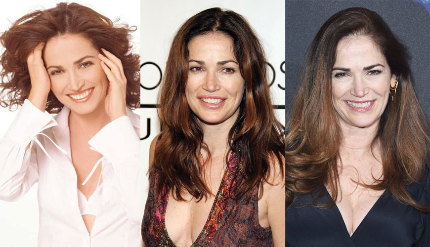Kim Delaney Plastic Surgery Before and After 2023