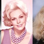 Kim Novak Plastic Surgery