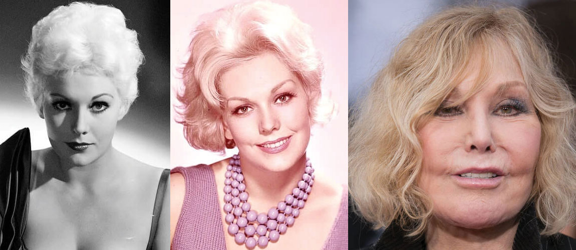 Kim Novak Plastic Surgery Before and After 2022