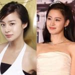 Kim Tae Hee Plastic Surgery