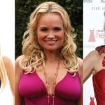 Kristin Chenoweth Plastic Surgery