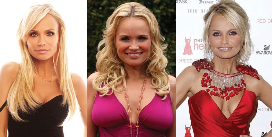 Kristin Chenoweth Plastic Surgery Before and After 2023