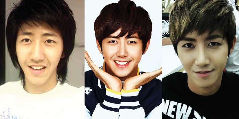 Kwanghee Plastic Surgery Before and After 2022