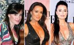 Kyle Richards Plastic Surgery