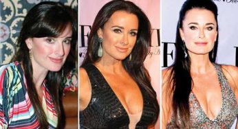Kyle Richards Plastic Surgery