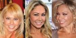 Kym Johnson Plastic Surgery