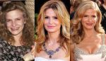 Kyra Sedgwick Plastic Surgery