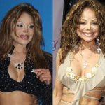 La Toya Jackson Plastic Surgery