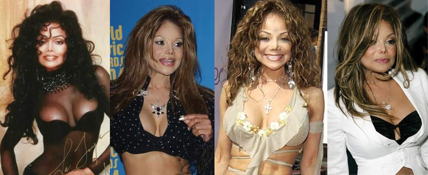 La Toya Jackson Plastic Surgery Before and After 2023