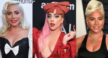Lady Gaga Plastic Surgery
