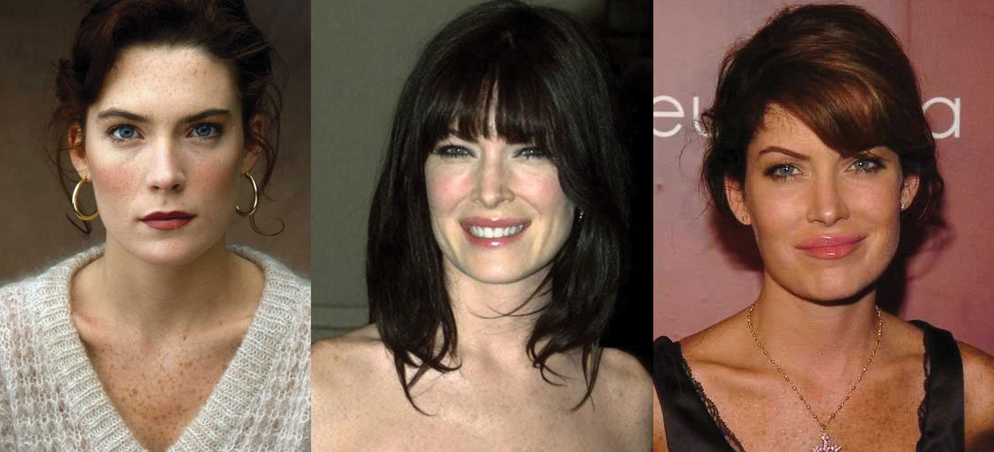 Lara Flynn Boyle Plastic Surgery Before and After Pictures 2024