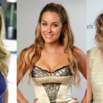 Lauren Conrad Plastic Surgery