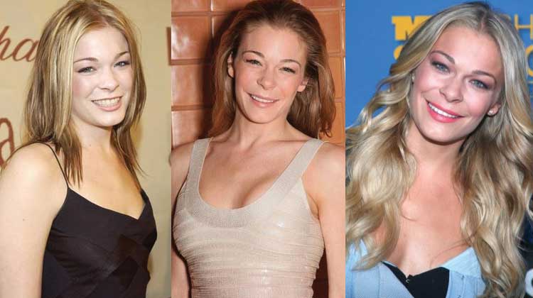 leann rimes plastic surgery